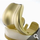 Beschichtete Knietotalendoprothese Beschichtete Knietotalendoprothese